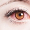 Can eyelash extension allergies go away?