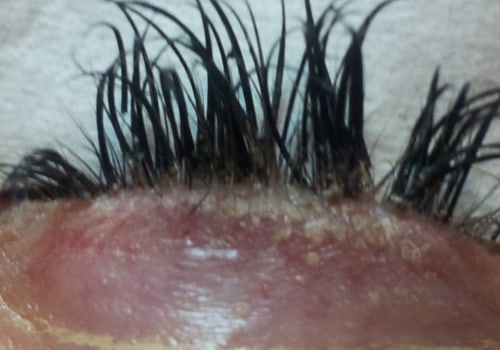 What happens when you stop eyelash extensions?